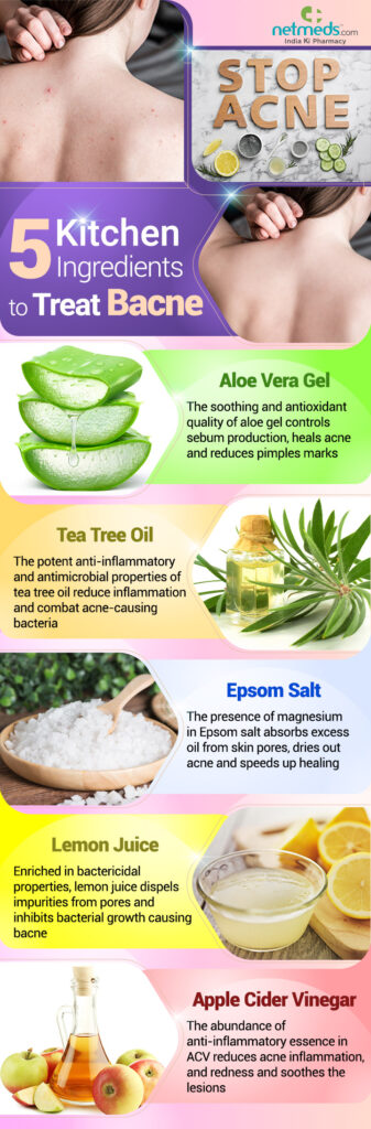 Natural Treatments For Acne: Home Remedies That Deliver Results
