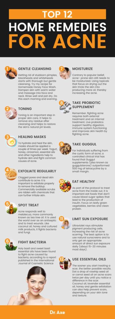 Natural Treatments For Acne: Home Remedies That Deliver Results