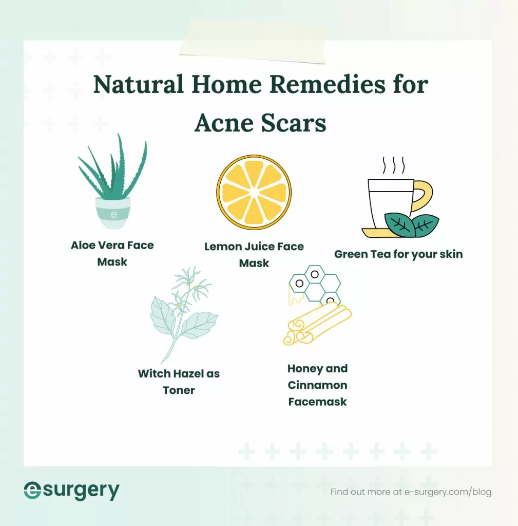 Natural Treatments For Acne: Home Remedies That Deliver Results