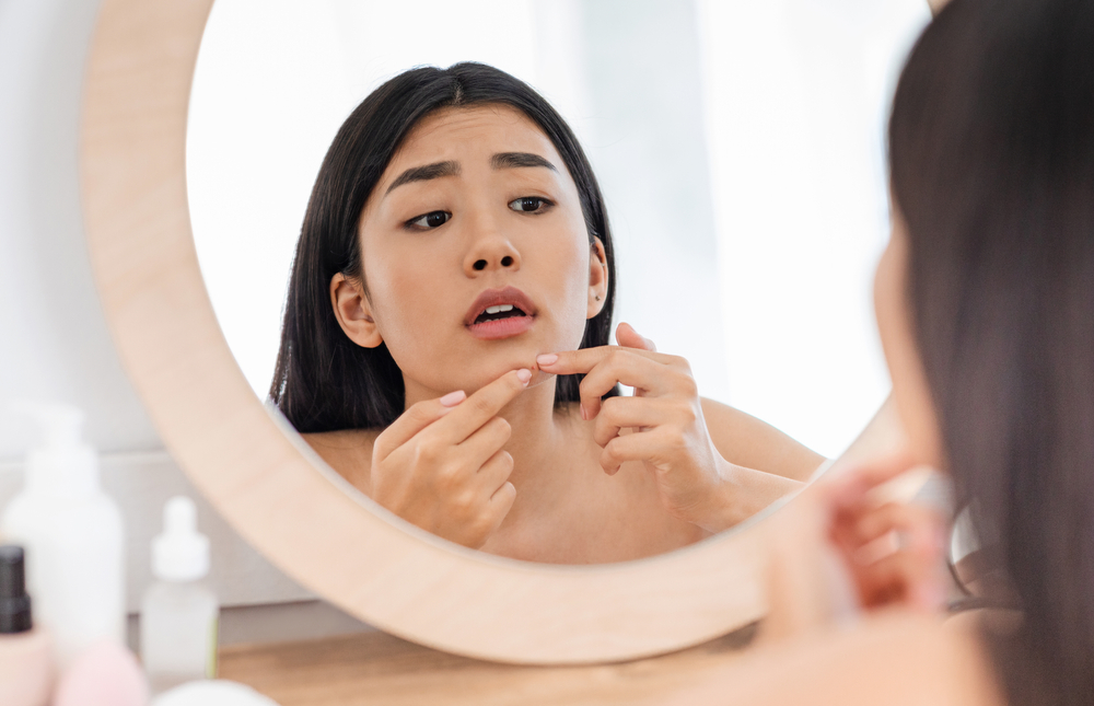 Pimple Scar Removal: Regaining Clearer Skin Confidence