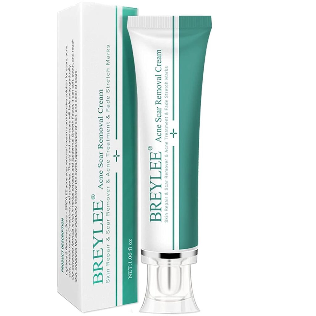 Acne Scars Creams: Top Picks For Scar Reduction