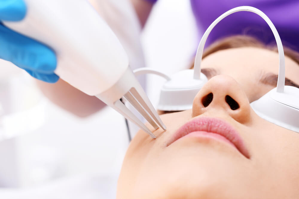 Choosing The Best Treatment For Acne Scars: Your Skins New Ally