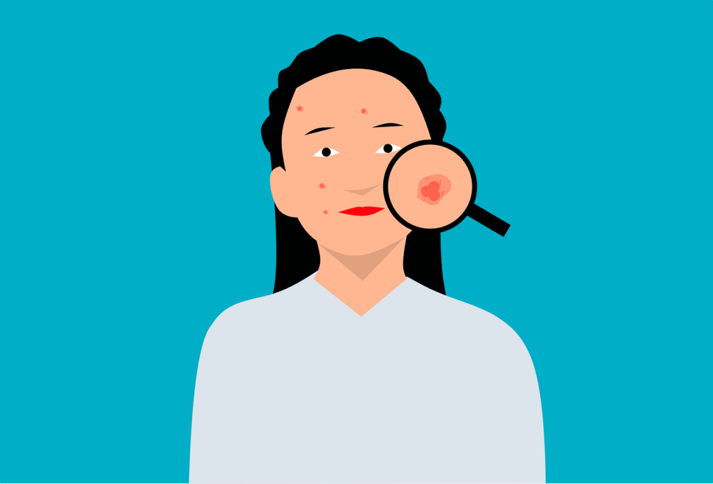 Do Acne Scars Go Away? Understanding Long-Term Outcomes