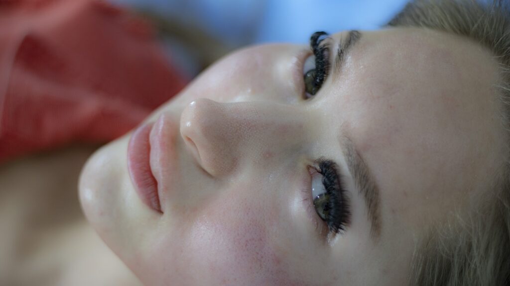 Get Rid Of Acne Scars Naturally: Holistic Approaches That Work Get Rid Of Acne Scars Naturally: Holistic Approaches That Work