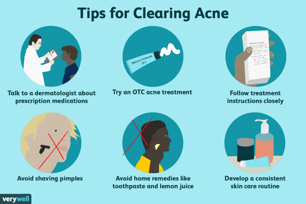 How To Get Rid Of Pimple Scars: Expert-Backed Strategies