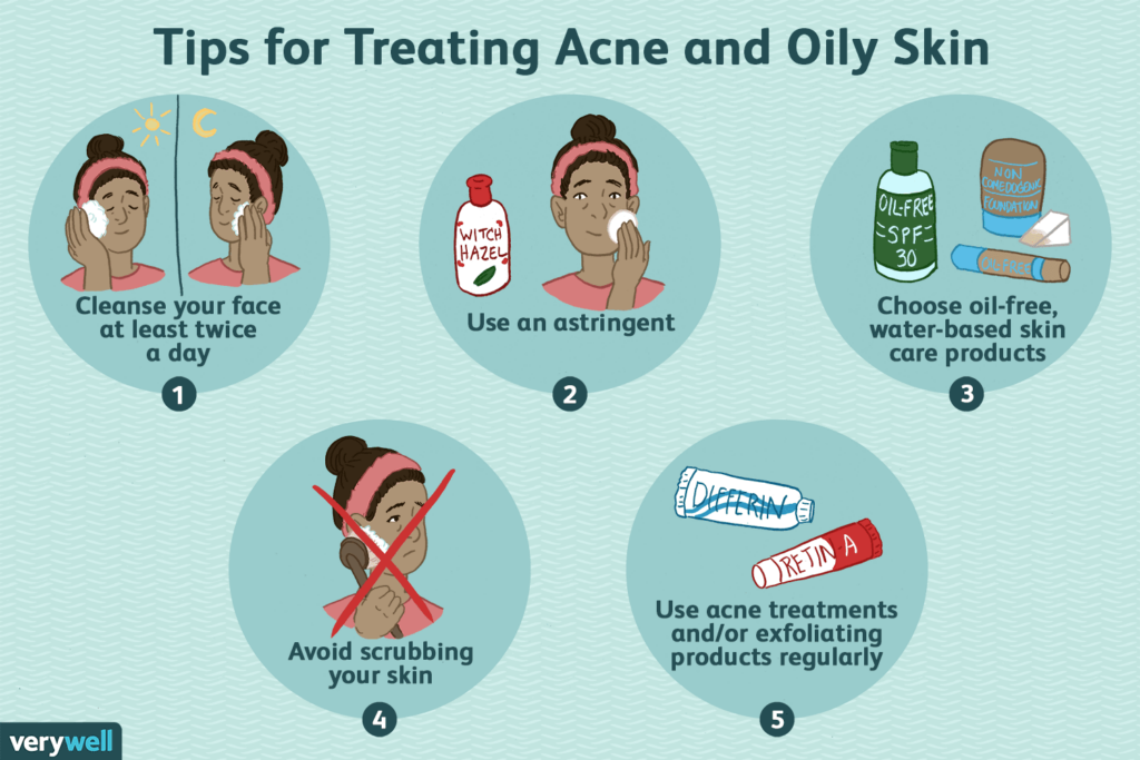 Remove Pimples Safely: Tips For Clear Skin Remove Pimples Safely: Tips For Clear Skin