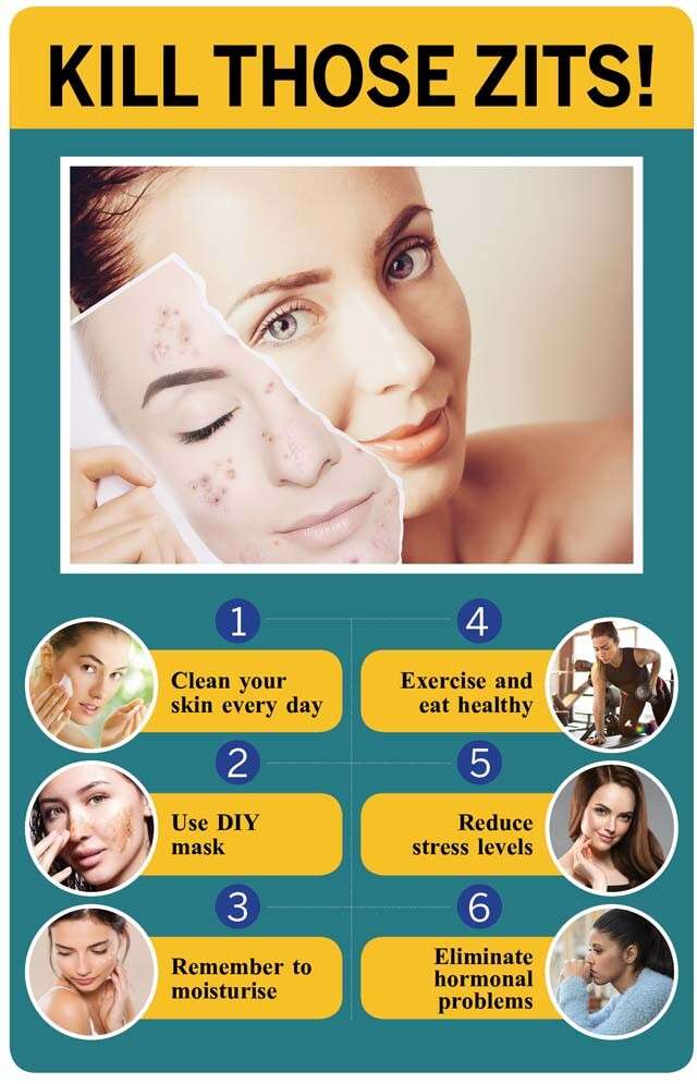 Remove Pimples Safely: Tips For Clear Skin Remove Pimples Safely: Tips For Clear Skin